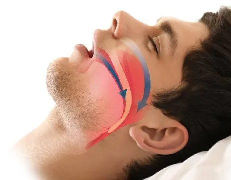 Diagram of nasal airway and breathing pathway