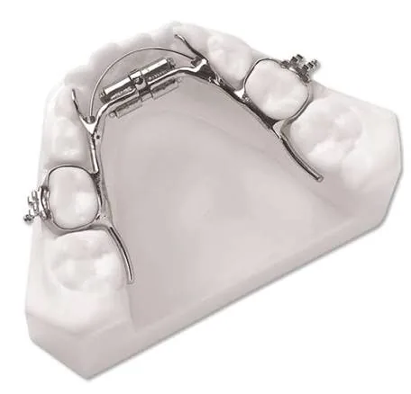 Model of a mandibular expansion appliance