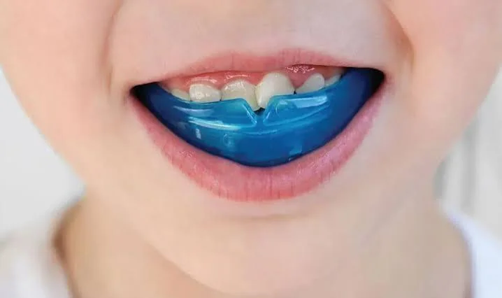 Child wearing a Myobrace appliance
