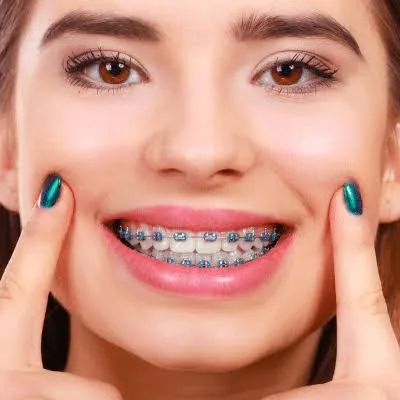 Patient smiling with traditional fixed braces